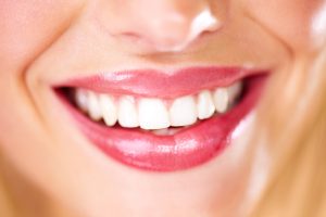 benefit from teeth whitening