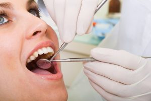 tooth colored fillings aftercare